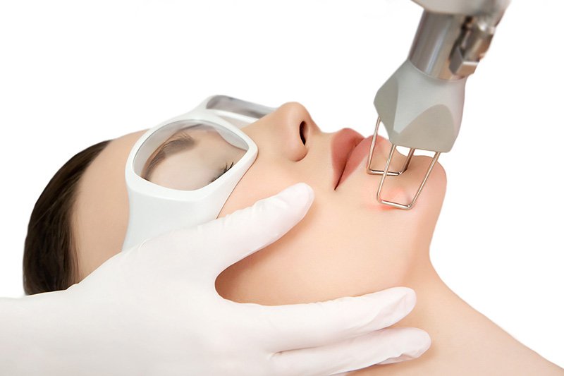 Trị Sẹo Thâm Tại Sen Beauty